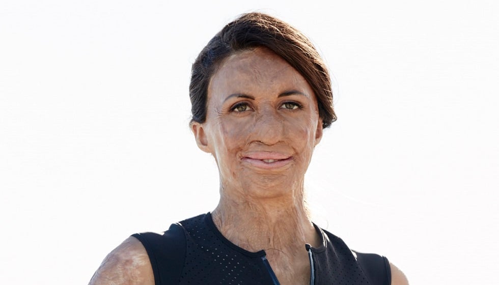 Turia Pitt: 'When you have the right mindset, anything is possible'