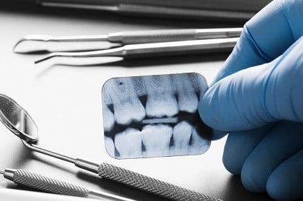 Calls for dental costs to be part of basic health care