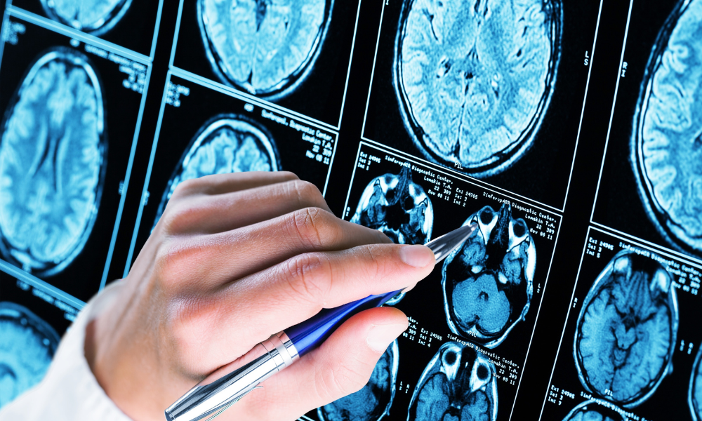 Total investments of $44.8 million to advance research on dementia, brain aging