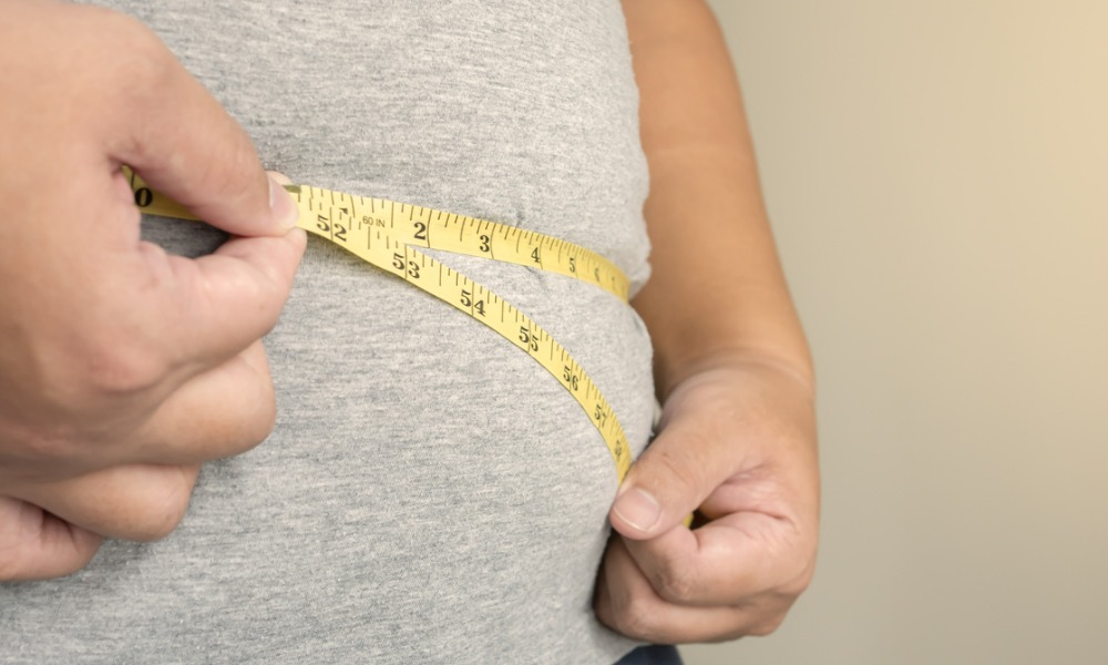 When does obesity qualify as an impairment?