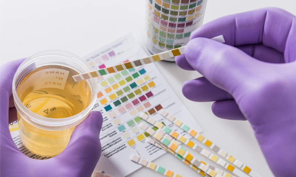 Can an employee refuse to provide a urine sample?
