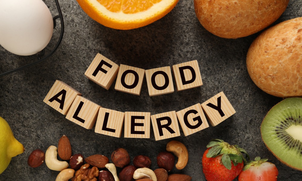 Food allergies in the workplace