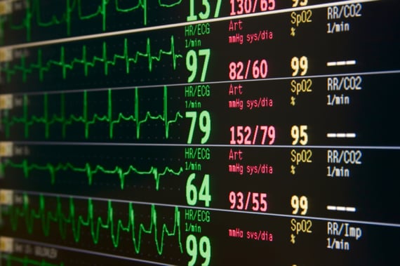Leading indicators indicate surprise for second half of year