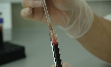 Hospital caught faking blood tests in apparent insurance scam