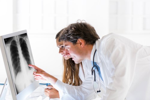 icare's lung screen trailer visits Nowra, NSW