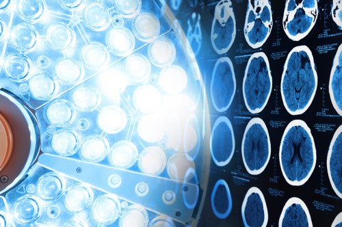 ICWA opens grant applications for neurotrauma research