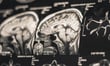 Raymond James, Baycrest expand brain health partnership
