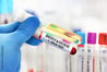 Court upholds ruling on SaskEnergy's post-incident drug testing
