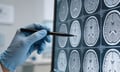 Divisional Court tosses Economical win in brain-injury benefits fight
