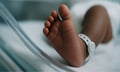 NICU claims drive rising severity pressures across reinsurance market – Gallagher Re