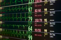 Leading indicators indicate surprise for second half of year