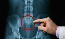 W.V. Supreme Court reinstates workers' comp benefits in MRI dispute