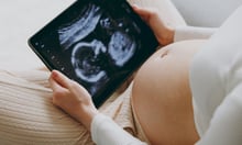 Manulife data exposes fertility benefits gap as Canada’s birth rate hits new low