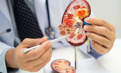 Chronic kidney disease kills nearly 8,000 Canadians a year, costs the economy $11.7 billion: report