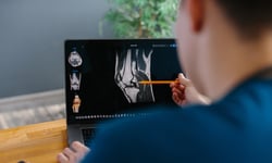 New study links GLP-1 drugs to fewer knee replacements