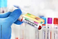 Court upholds ruling on SaskEnergy's post-incident drug testing