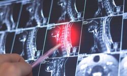 Court quashes medical panel opinion in Woolworths injury claim