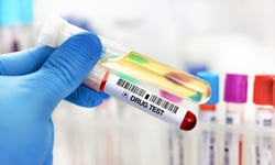 'Rigid' drug and alcohol policy costs employer $25k