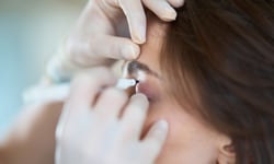 Same-day flights after overseas eyelid surgery are an insurance question UK brokers can't ignore