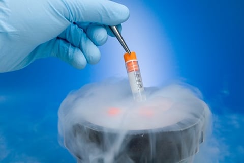 Insurance and the cryogenics issue
