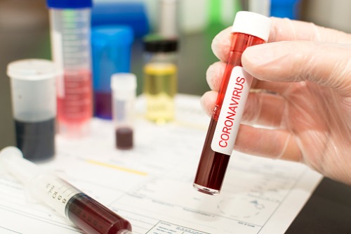 Preparing for coronavirus now will help employers in the long-term