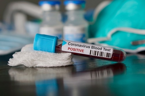 UniMelb researchers have made a breakthrough in search for coronavirus cure
