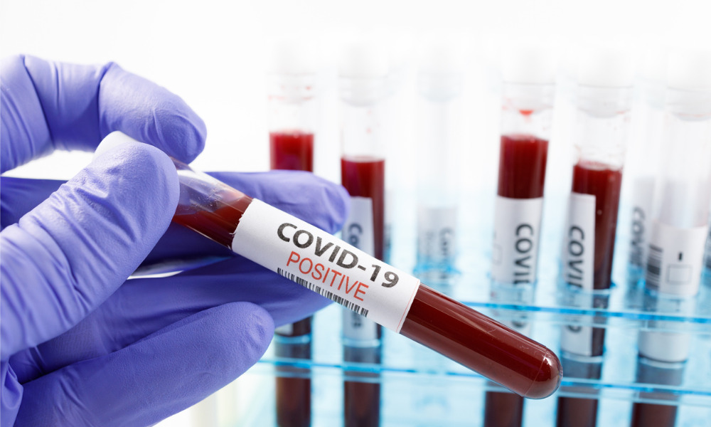 COVID-19: Your employee tested positive – what should you do?